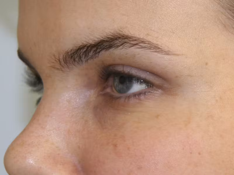 gal-image