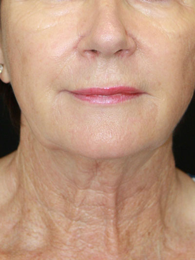 gal-image