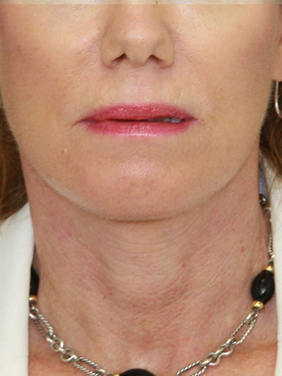 gal-image