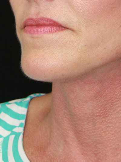 gal-image