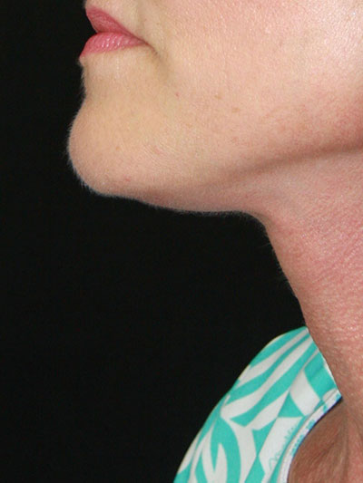 gal-image