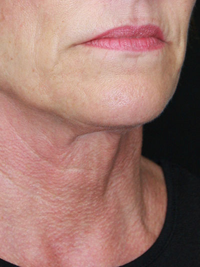 gal-image