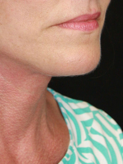 gal-image