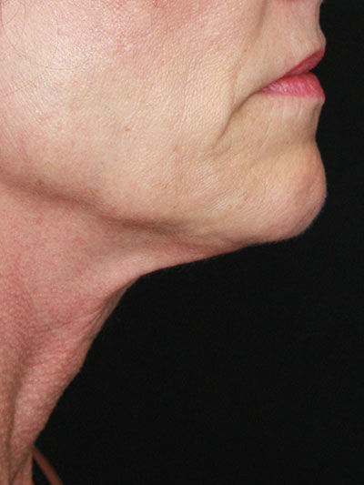 gal-image