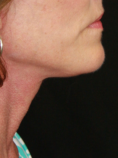 gal-image