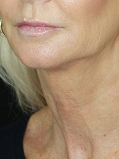 gal-image