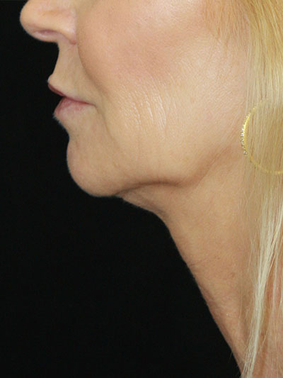 gal-image