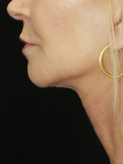 gal-image