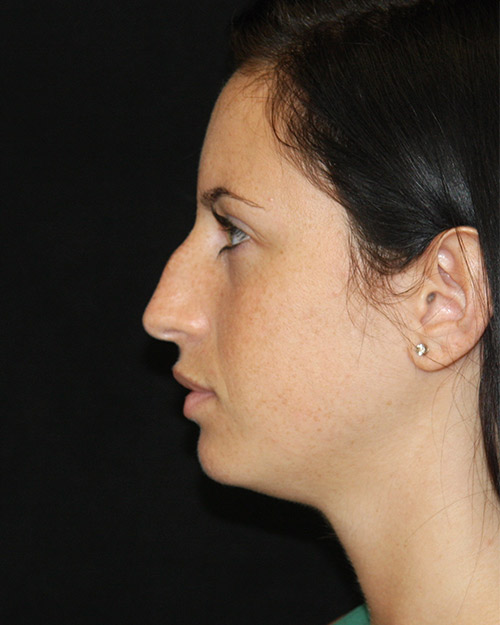 gal-image
