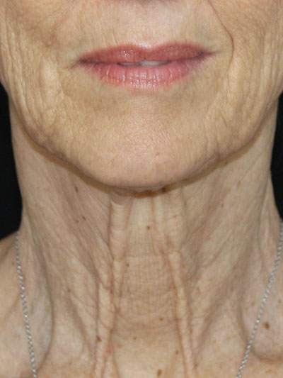 gal-image