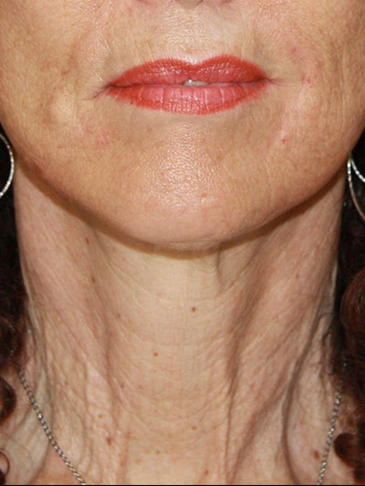 gal-image