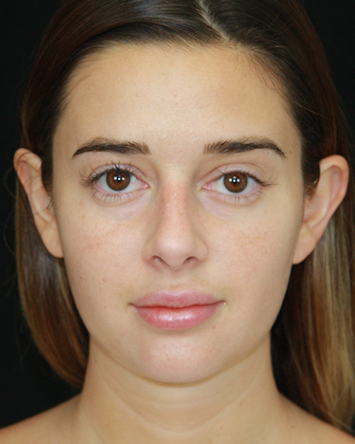 gal-image