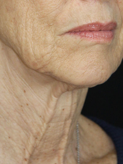 gal-image