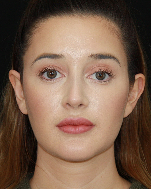gal-image