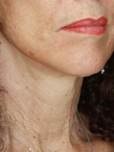 gal-image