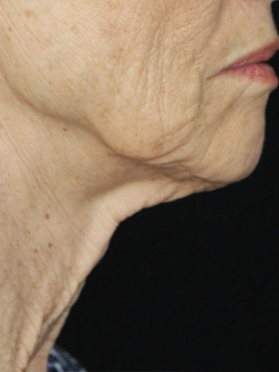 gal-image