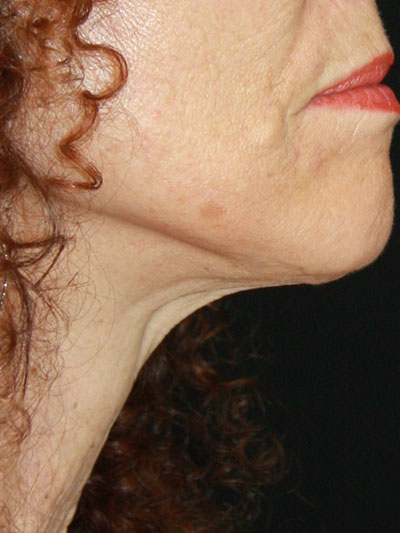 gal-image