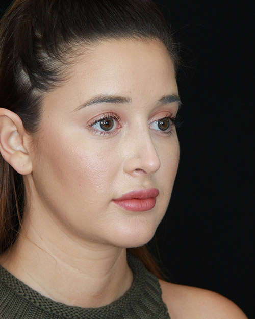 gal-image