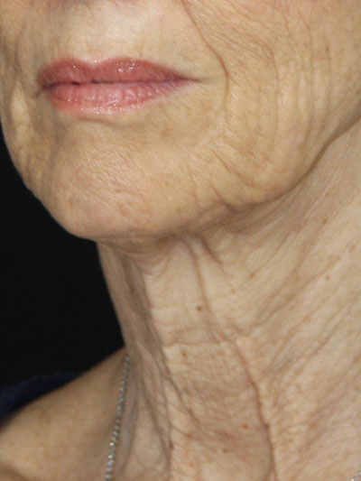 gal-image
