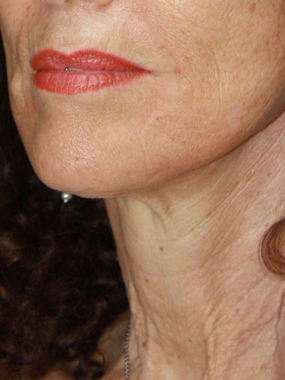 gal-image