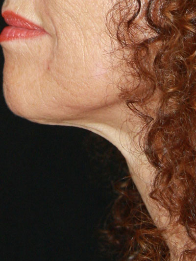 gal-image