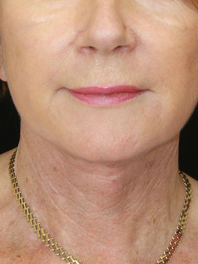 gal-image