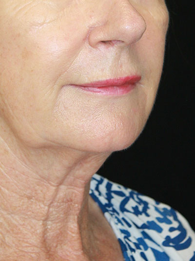 gal-image