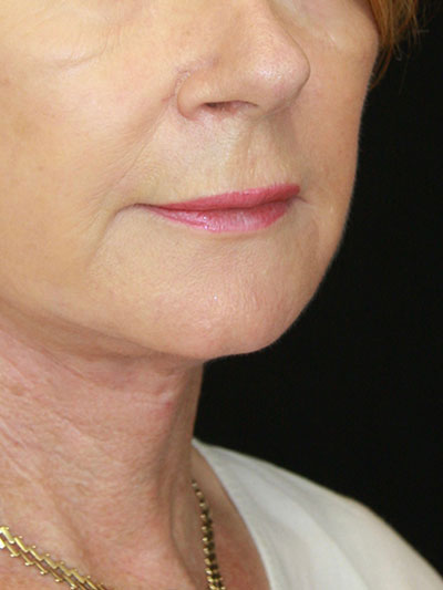 gal-image