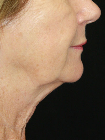 gal-image