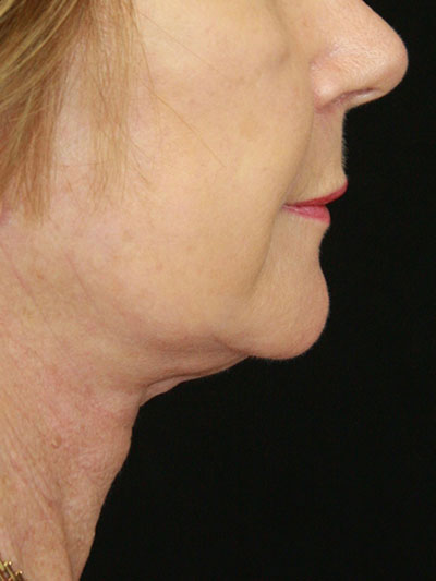 gal-image