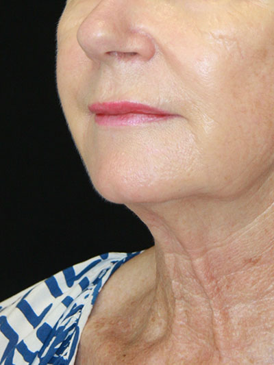 gal-image