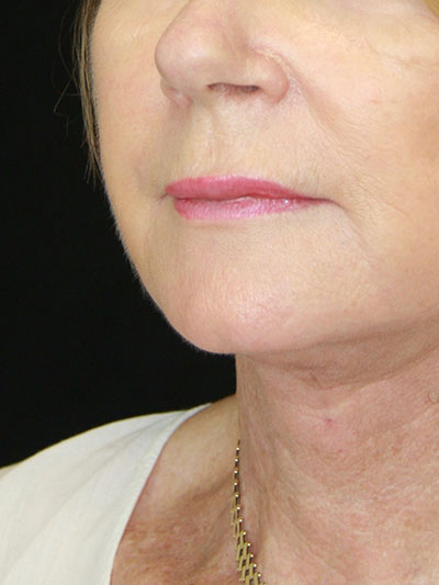 gal-image