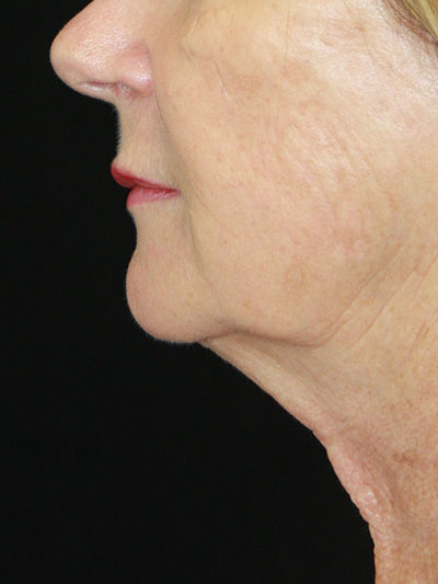 gal-image