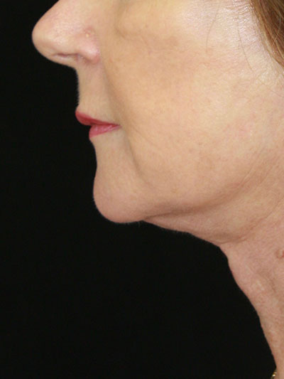 gal-image