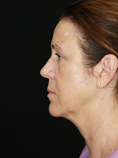 gal-image