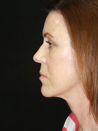 gal-image