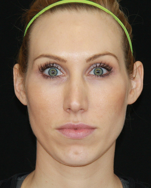 gal-image