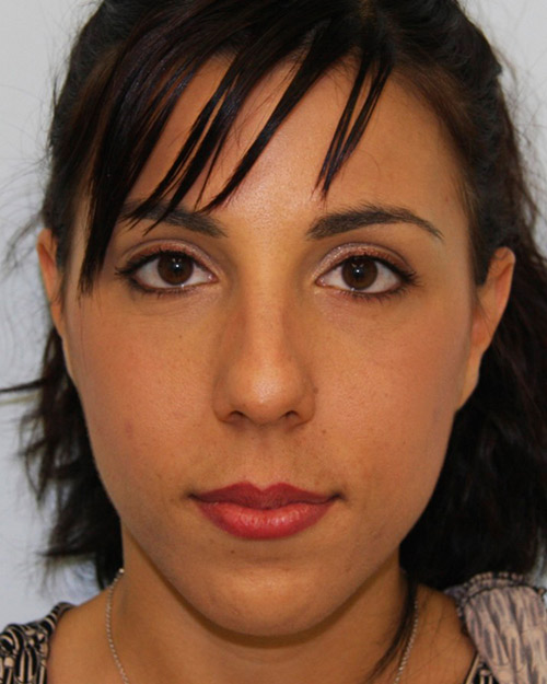 gal-image