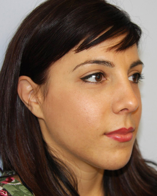 gal-image