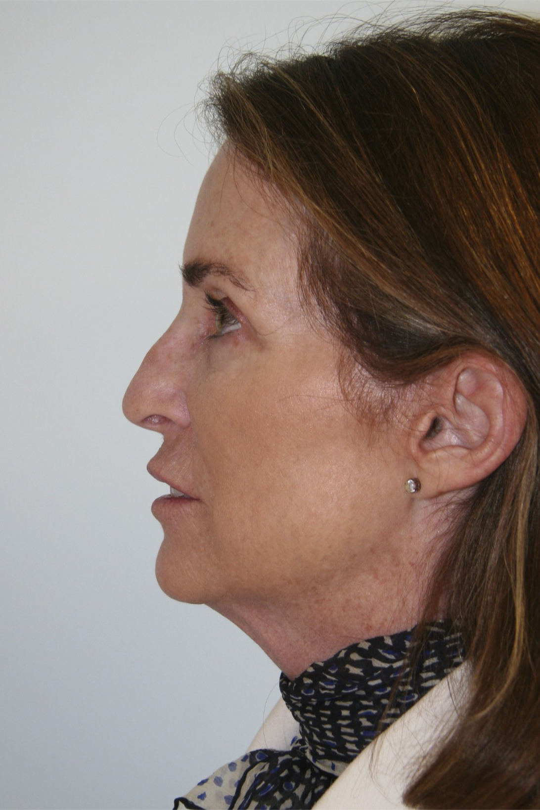 gal-image