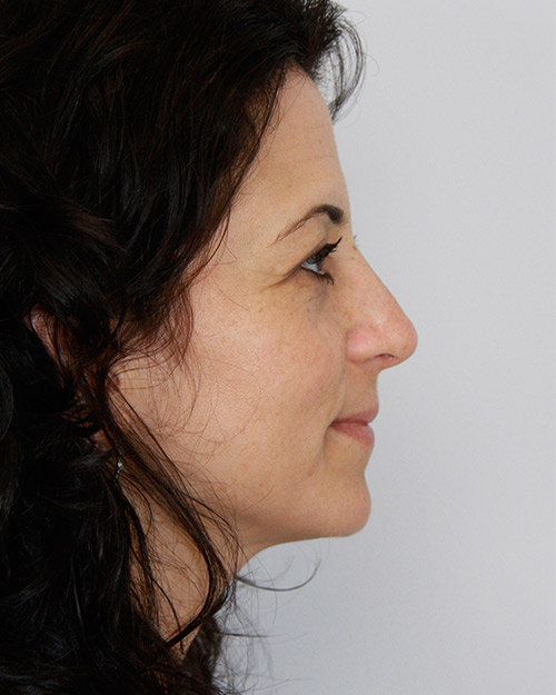 gal-image