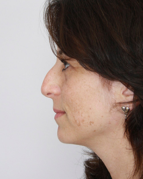 gal-image