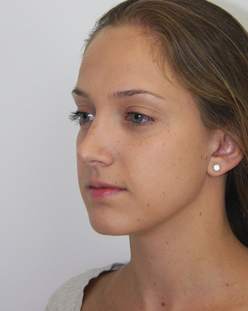 gal-image