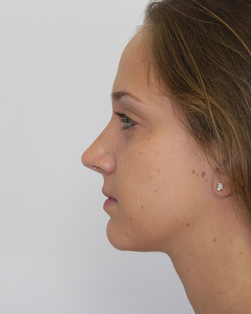 gal-image