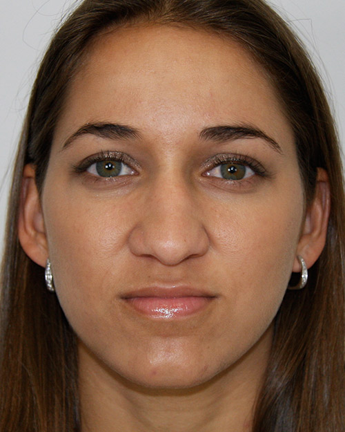gal-image