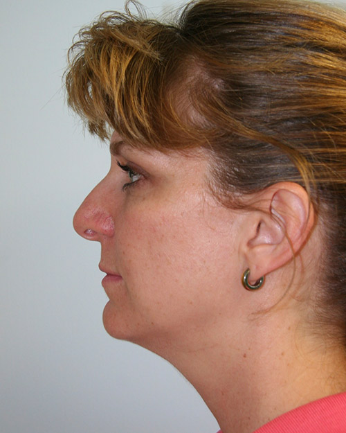 gal-image