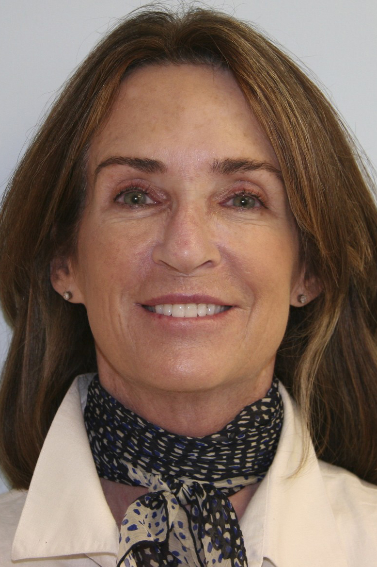 gal-image