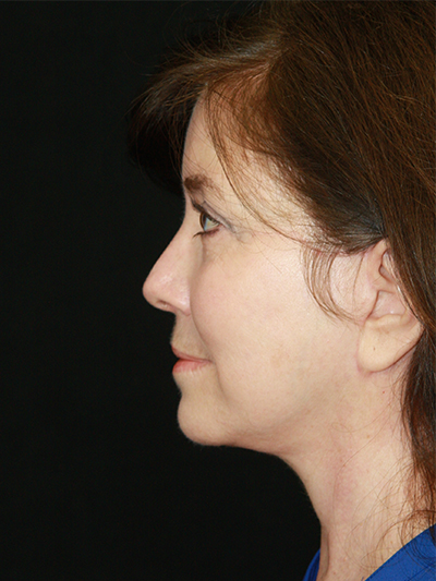 gal-image