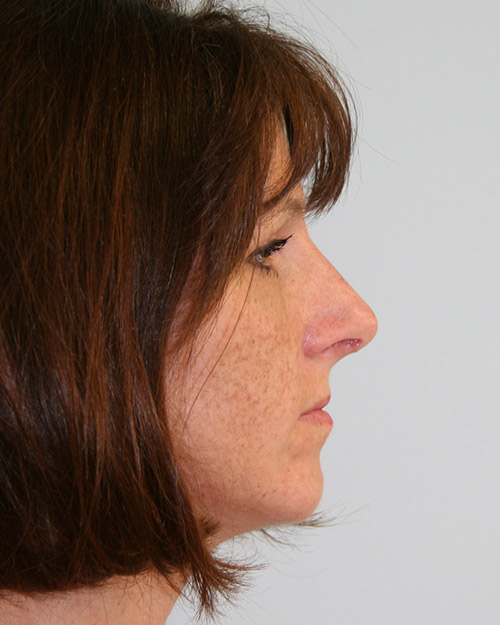 gal-image