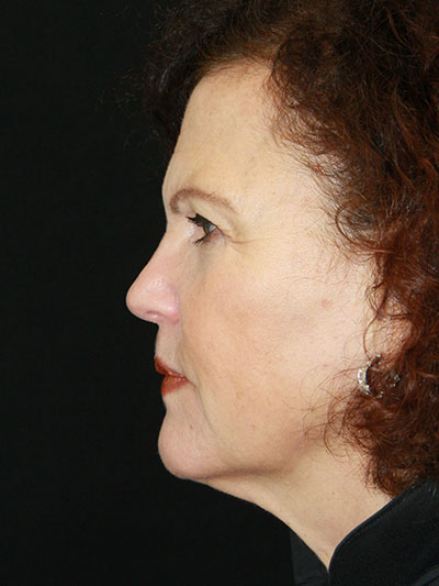 gal-image